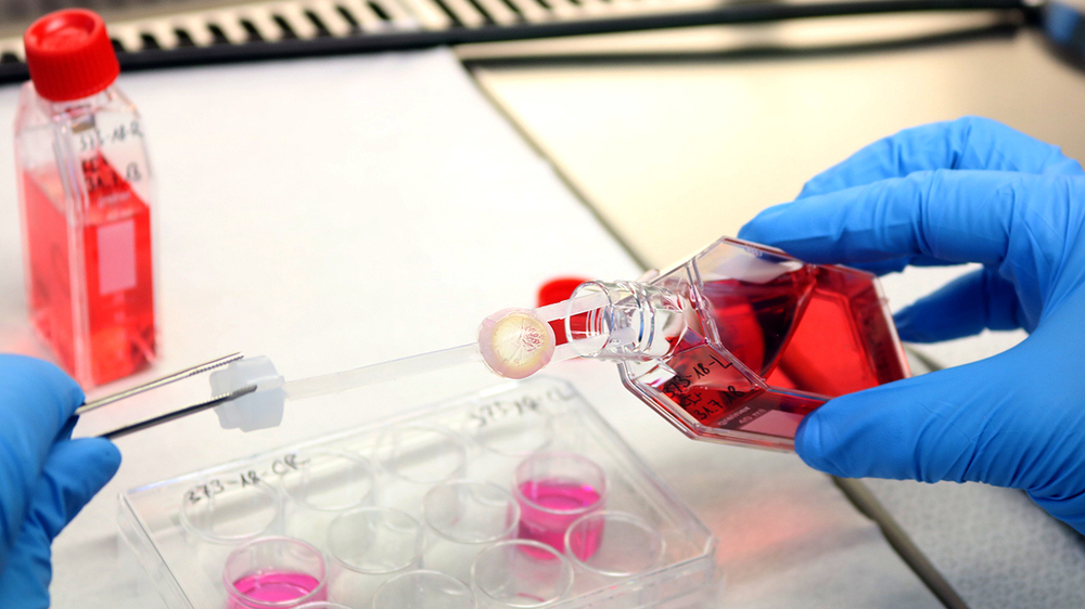 Hornhautprozessierung - Hornhaut gelangt in das Kulturmedium - Foto: DGFG